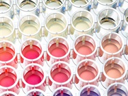 Selecting the Right Cell-Based Assay