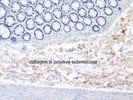 Useful Collagen III Antibody from Biorbyt