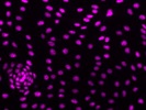 High Performing WT1 Antibody for Immunofluorescence