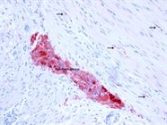 Good Neuron-Specific Enolase for Some Species
