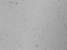 Easy to Grow Placental Vessel Endothelial Cells
