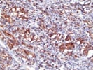 Great Signaling with Origenes' CD56 (NCAM) for IHC