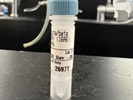 Time Course Effect of Chemoattractant on Phospho-IKKa/ß Phosphorylation