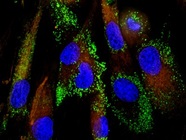 A Guide to Mesenchymal Stem Cell (MSC) Markers