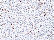 Legendary Cleaved Caspase 3 Antibody from Abcam