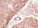 Novus Biologicals' CD79a Antibody Works for IHC