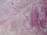 Complete Kit for Trichrome Staining
