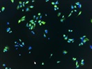 Great Anti-Galectin 1 Antibody for Staining Neurons