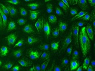 Successful Immunofluorescent Staining of Vimentin
