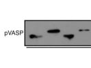 Good Marker for Phosphorylated VASP From Abcam
