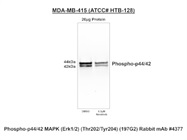 Choose Correct Phospho-p44/42 (Erk1/2)