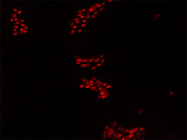 Excellent HuC/D Antibody From Abcam