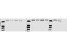 Very Clear Staining With Cyclin E1 Rabbit mAb From Cell Signaling