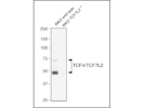 TCF4/TCF7L2 Antibody for Western Blotting From Cell Signaling
