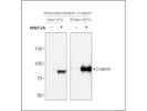 Protein G Magnetic Beads for Immunoprecipitation From Thermo Fisher