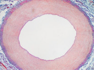 A Guide to Endothelial Cell Markers