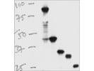 Coupled Transcription/Translation Kit From Promega