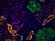 Antibody Labeling Principles, Advantages, and Considerations