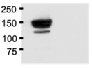 Great GFP Antibody for Western Blot and Immunofluorescence From Novus Biologicals