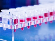 Developing Novel Biomarkers with Liquid Biopsy