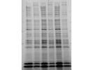 Stain-Free Precast Gels From BIO-RAD for Polyacrylamide Gel Electrophoresis