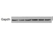 Best GAPDH Antibody From Abcam