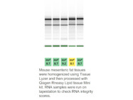 Easy-to-Use RNeasy Lipid Tissue Mini Kit From Qiagen