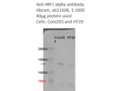 Anti-HIF-1 alpha Antibody From Abcam With Great Signal