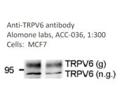 Good Choice of TRPV6 Antibody From Alomone Labs