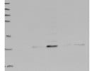 Great Antibody From Novus Biologicals to Detect FABP4 in Human Cells