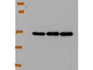 Best Novus Biologicals Antibody Against LXR Alpha