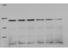 Good Abcam Antibody for the Immunodetection of Parkin in Human Cells