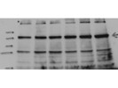 Good Antibody for the Detection of Vinculin in a Human Sample