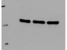 Excellent Antibody to Detect NFkB in Human Cells.