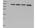 Excellent Anti-HIF1 Alpha Antibody From GeneTex