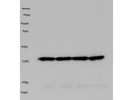 Excellent Antibody for the Immunodetection of Thrombopoietin in Human