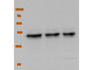 Best Specificity of Abcam Antibody for the Immunodetection of Beta-Catenin Protein Levels in Human Cells