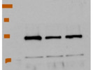 State of the Art Antibody for the Detection of FAK in Human Cells