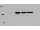 Excellent Antibody for the Detection of Nicotinic Acetylcholine Receptor beta 2 in Human Cell