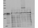 Average Anti-Cullin 2/CUL-2 Antibody from Abcam