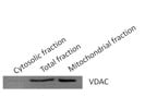VDAC Antibody for Mitochondrial Loading Control From Abcam