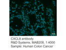 Good CXCL8 Antibody From R&D