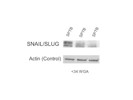 SNAIL/SLUG Antibody From Abcam Works Fine