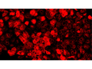 Ideal CK18 Antibody From Abcam