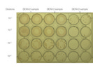AEC Peroxidase Substrate Kit From Enzo for Focus Forming Assay