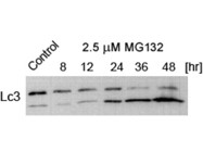 Autophagy Marker Antibody From Abcam