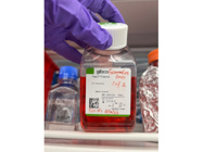 Reagent From Gibco Works Very Well to Dislodge Cells While Being Gentler Than Trypsin