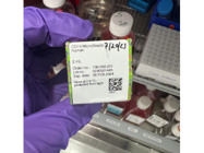 CD14 MicroBeads From Miltenyi is an Easy and Reliable Way to Separate PBMCs