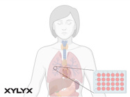 Human IPF Assays for Drug Testing