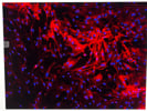 Excellent MUC18 Antibody From Abcam for Endothelial Cells